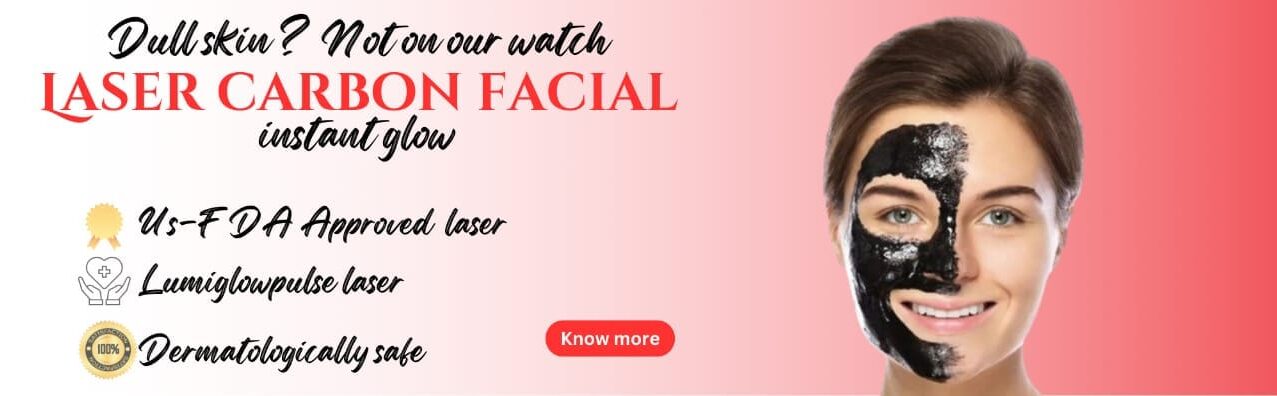Laser Carbon Facial – Brighter Skin with Safe, USFDA Approved Laser A promotional image for Laser Carbon Facial with the tagline “Dull skin? Not on our watch” showing a safe, glowing skin treatment option.